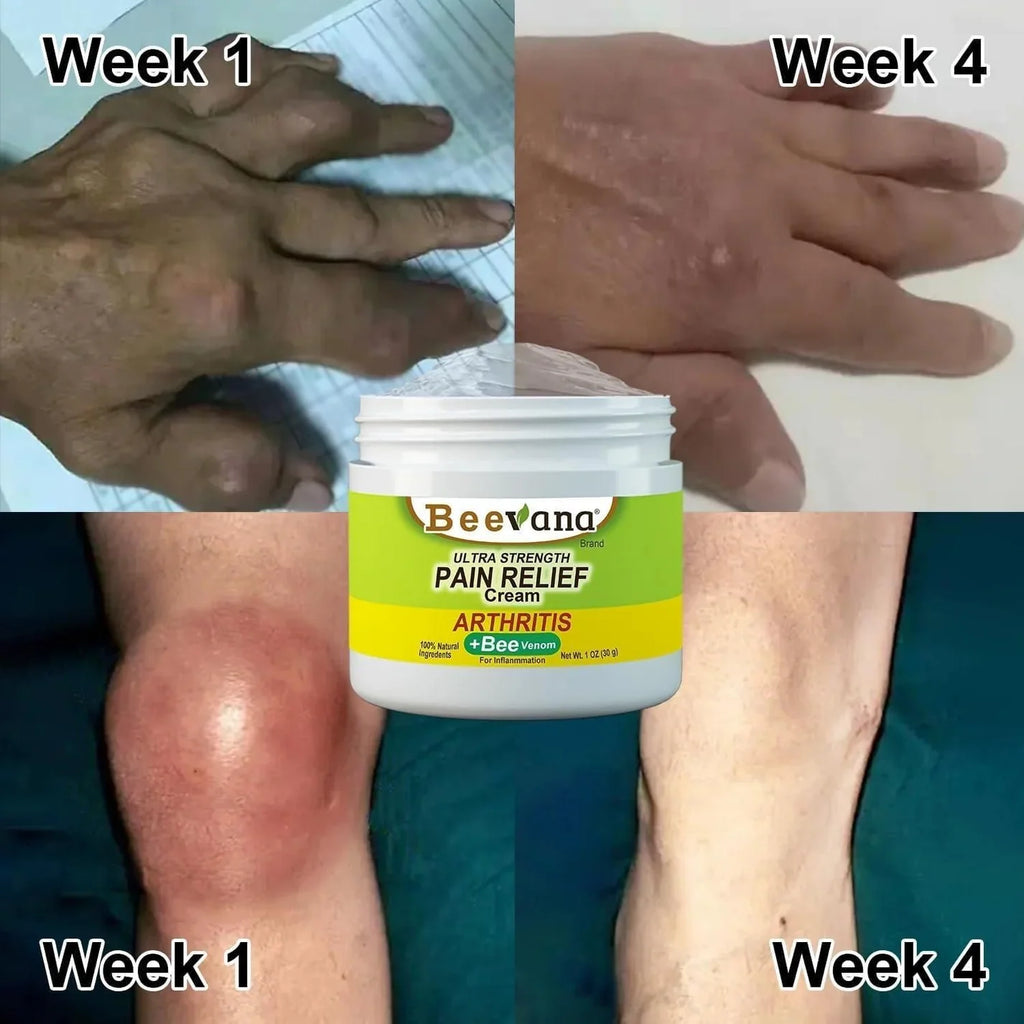 Joint and Bone Therapy Organic BeeVenom Cream (COD Available + BUY 1 GET 2 FREE)