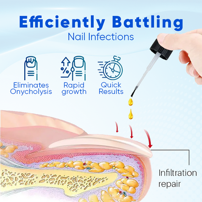 OnyxoGuard Nail Growth and Repair Serum (BUY 1 GET 1 FREE + COD)