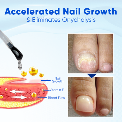 OnyxoGuard Nail Growth and Repair Serum (BUY 1 GET 1 FREE + COD)