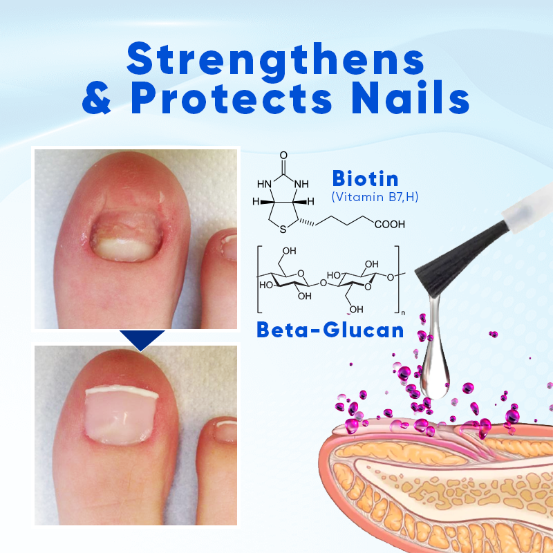 OnyxoGuard Nail Growth and Repair Serum (BUY 1 GET 1 FREE + COD)